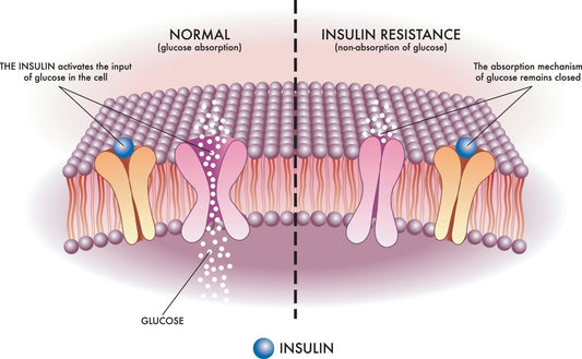 Insulinresistenz,was ist das ? - Vitalitaet 360